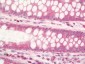 Anti-RPL3 / Ribosomal Protein L3 Antibody 